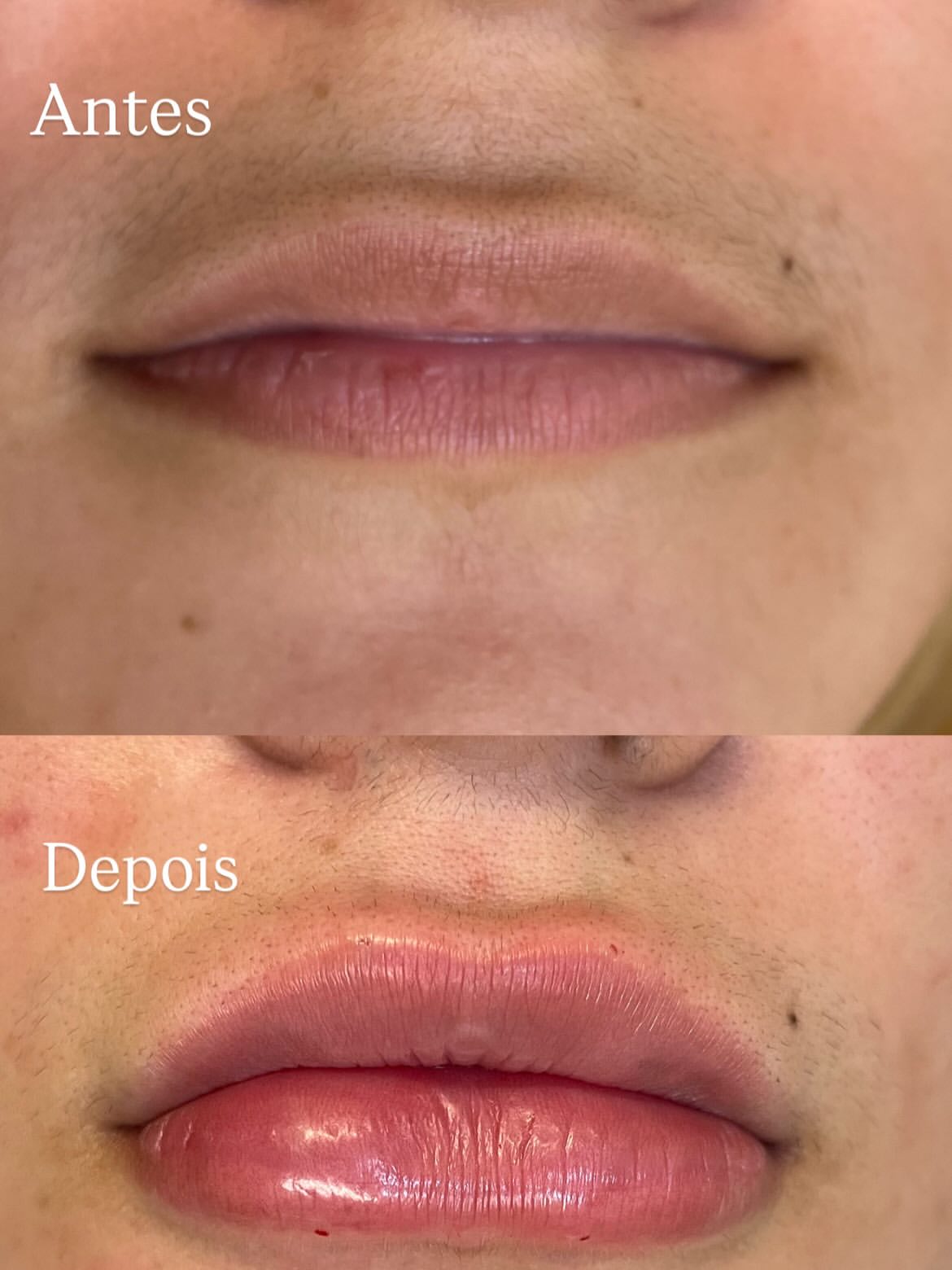 Antes e Depois 1